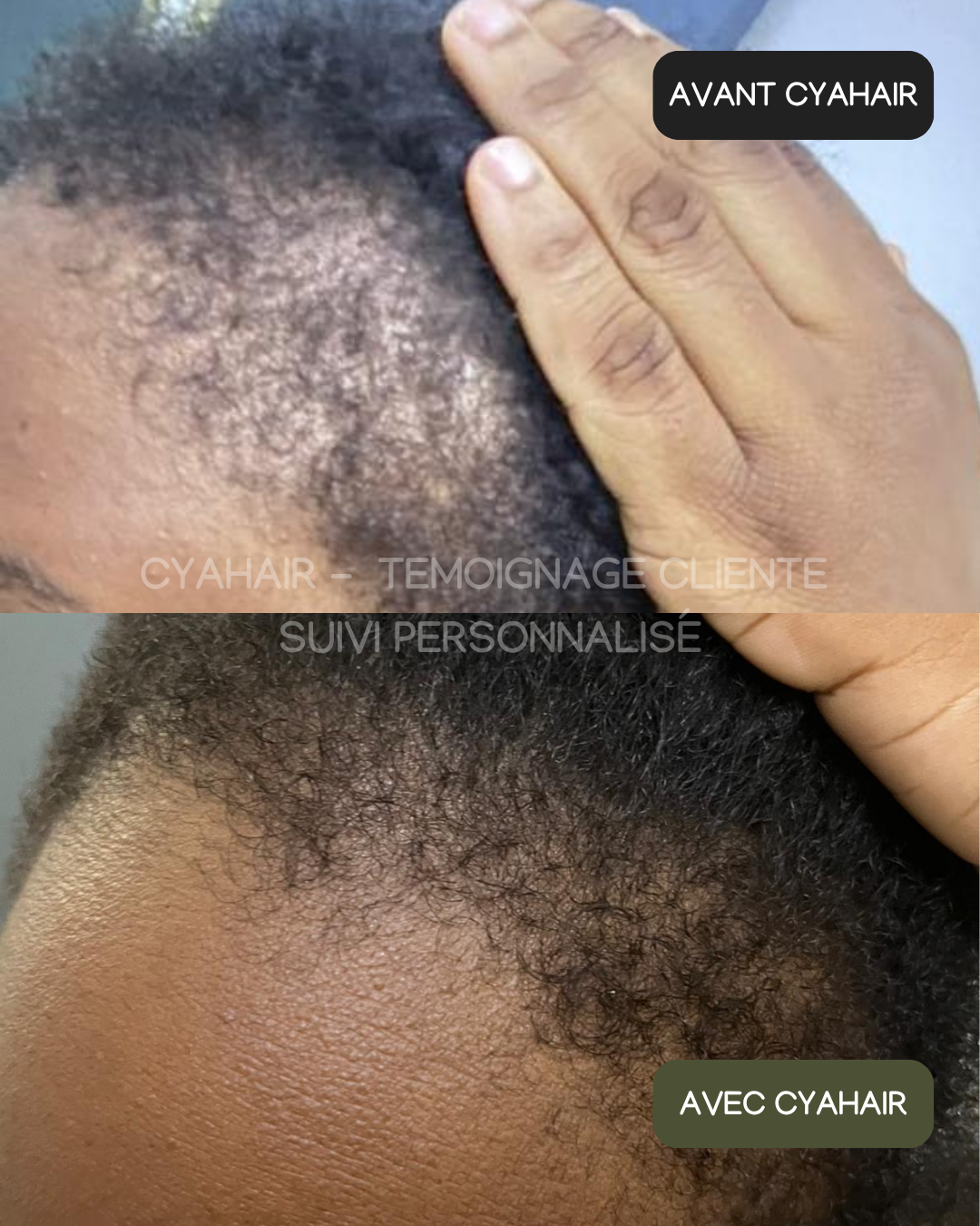 SÉRUM REPOUSSE & BABY HAIR PLUS FORTS