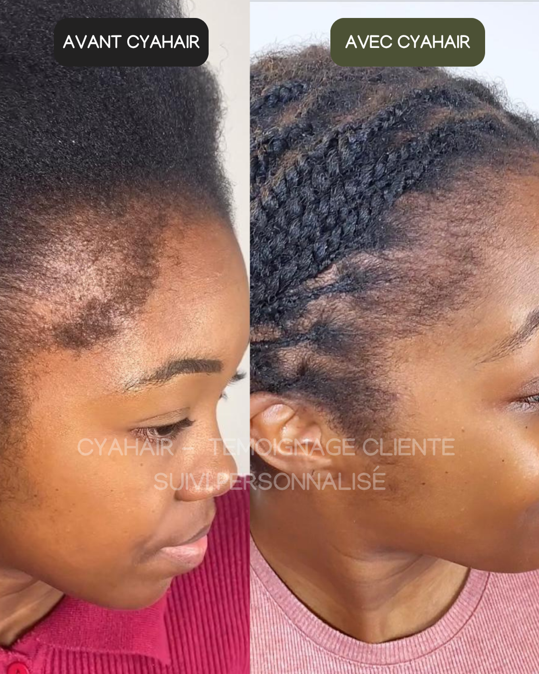 SÉRUM REPOUSSE & BABY HAIR PLUS FORTS