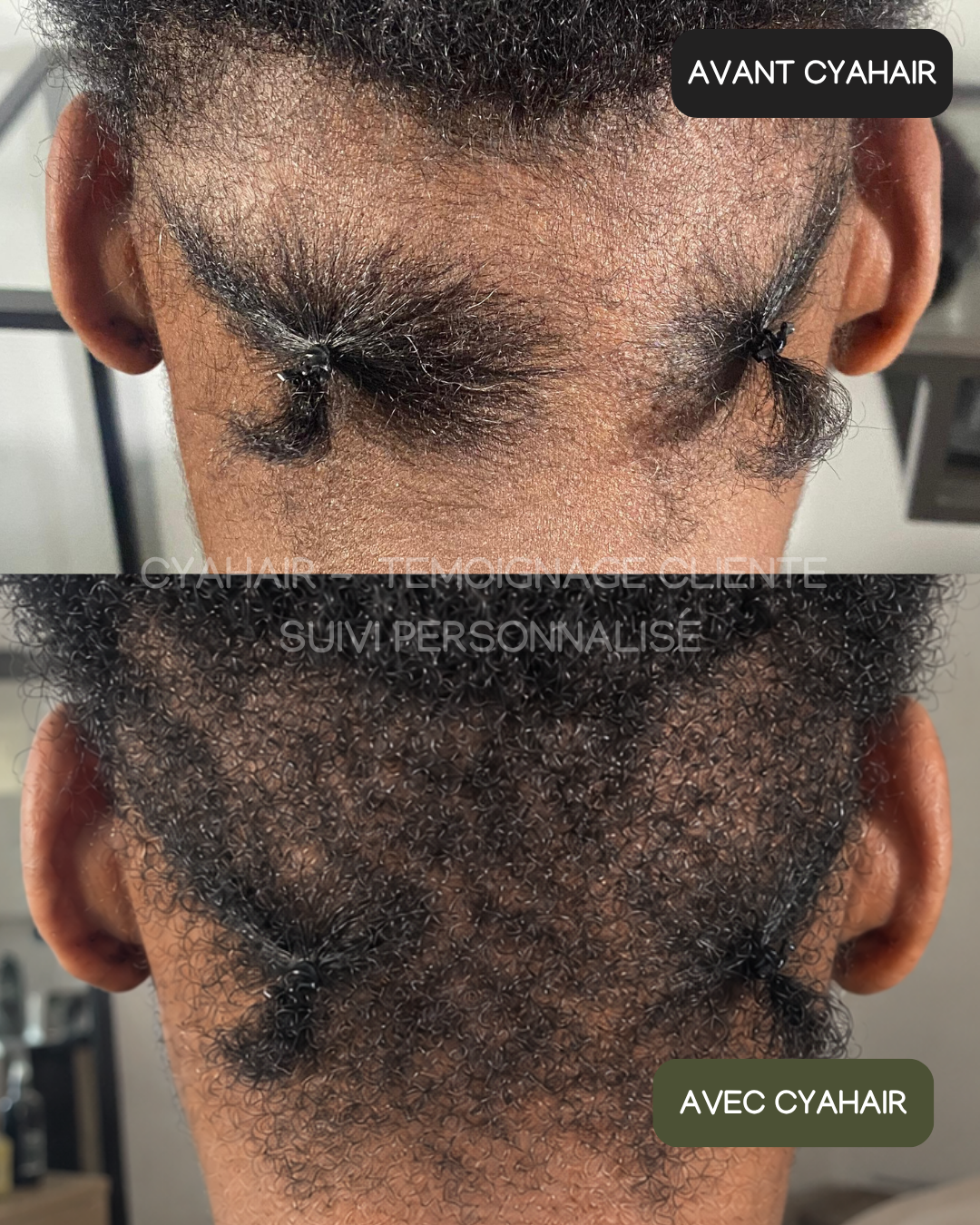 SÉRUM REPOUSSE & BABY HAIR PLUS FORTS